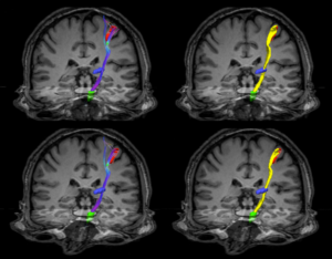 Projects Neuroimaging