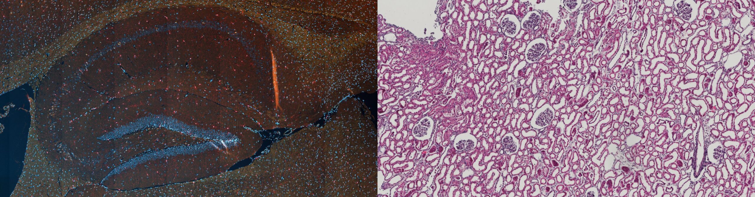 Left Side: Mouse Brain/Right Side: Kidney stained with Hematoxylin and Eosin Left Side: Mouse Brain/Right Side: Kidney stained with Hematoxylin and Eosin